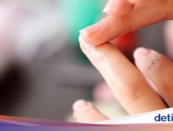 Ciri Kuku Seperti Ini Pertanda Kanker? Praktisi Medis Beri Penegasan